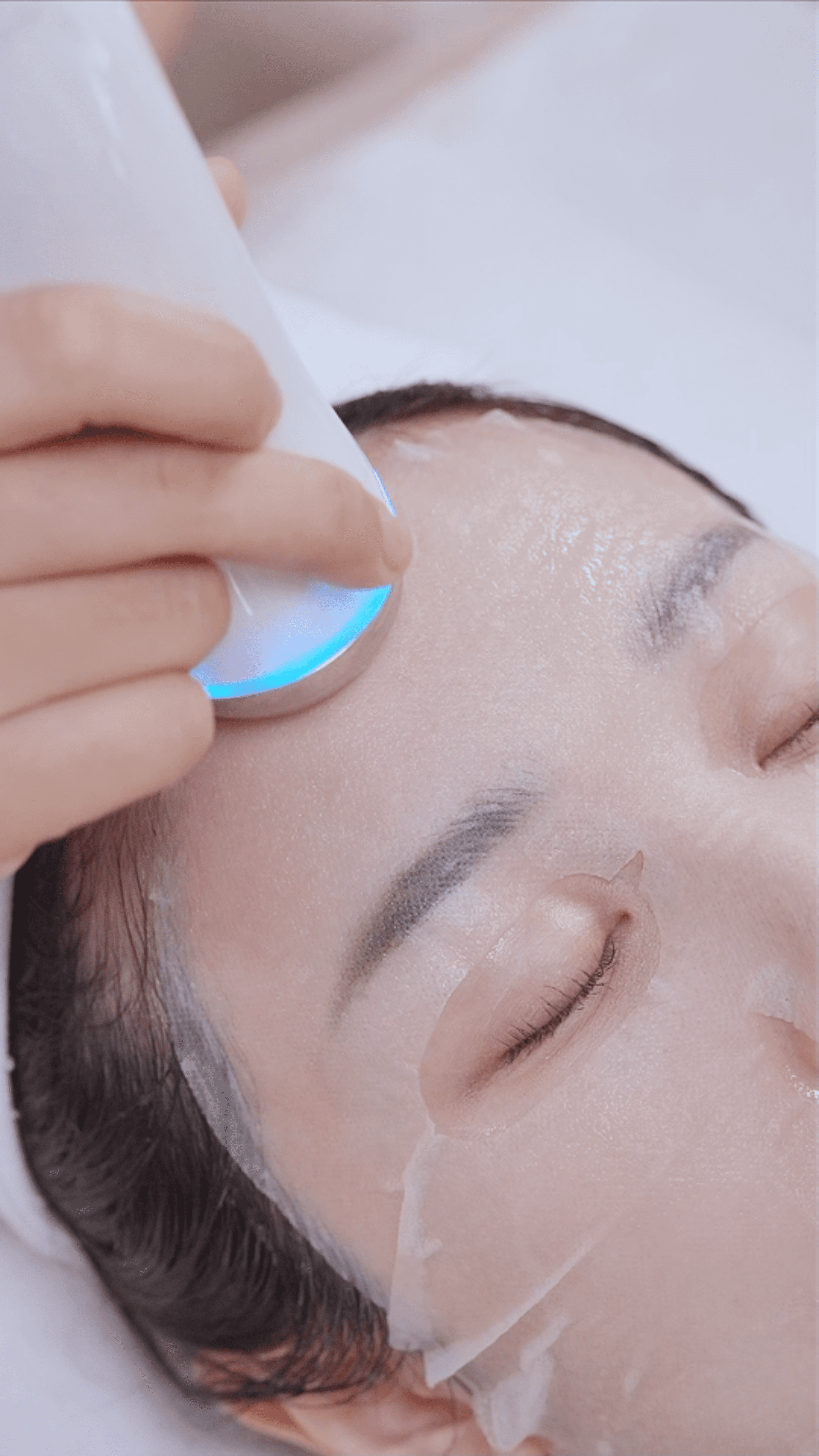 Điện di lạnh trên mặt nạ